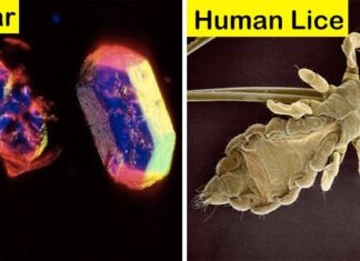 Things Seems Differently Under Microscope