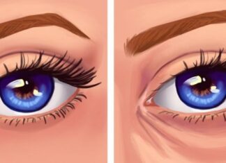 Not So Obvious Habits That Can Give You Wrinkles