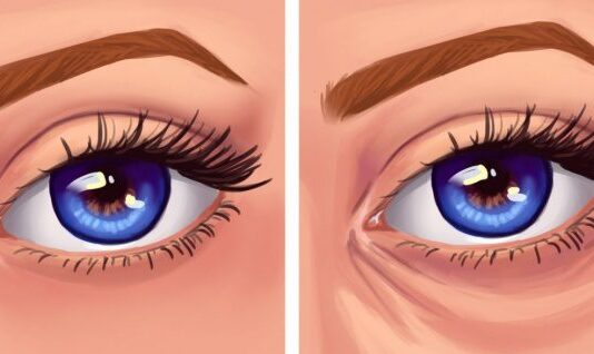 Not So Obvious Habits That Can Give You Wrinkles