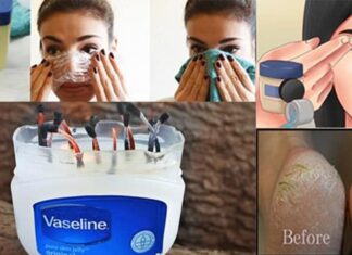 16 Awesome Life Hacks For Vaseline You Should Know
