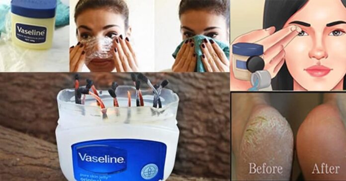 vaseline