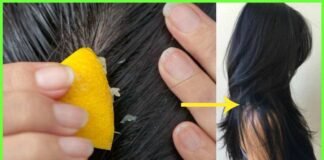 Stepping out for your hair detox? Stay back home and DIY, here’s how