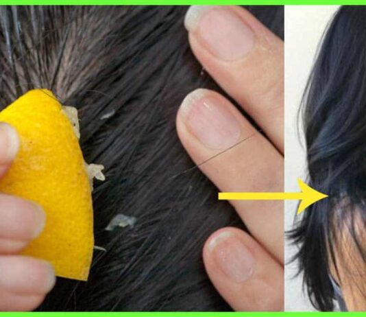 Stepping out for your hair detox? Stay back home and DIY, here’s how