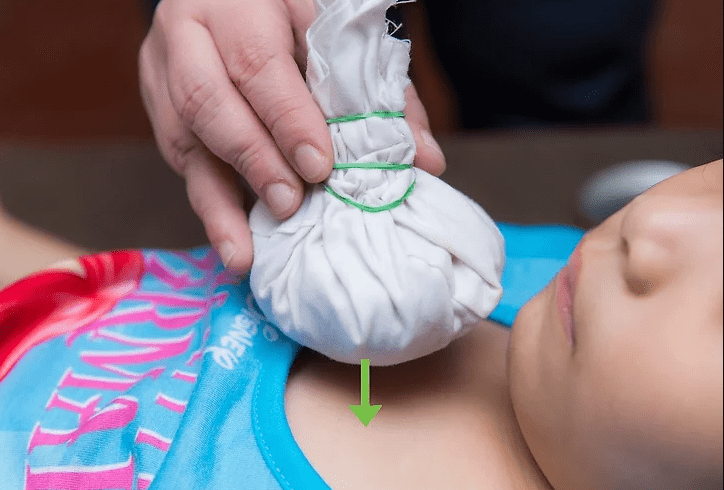 Natural Onion Remedies