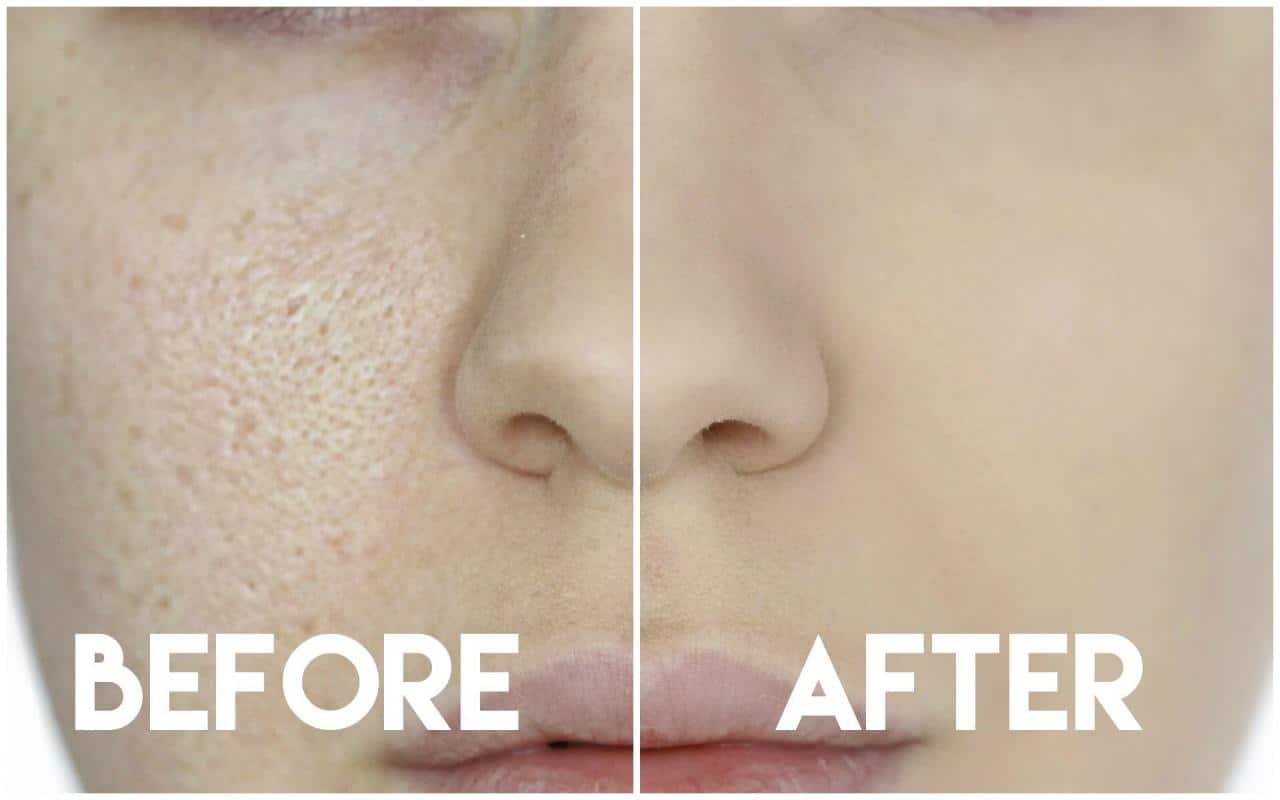 Natural Beauty Tricks