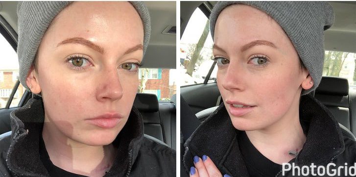 6 Best Tested Tips By Girls Who Have Managed To Get Flawless Skin