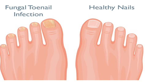 Best tips to make your feet look perfect