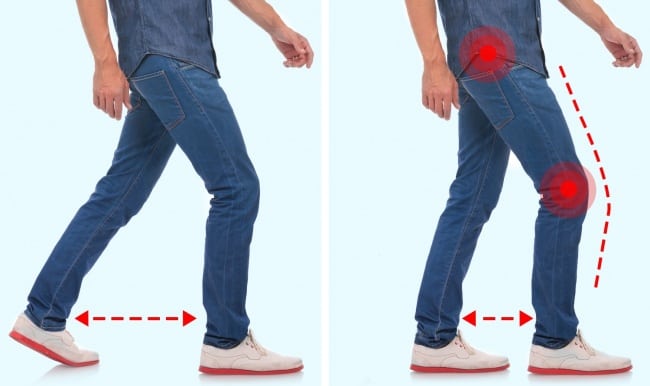 Your walking style can reveal your health problems