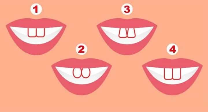 What the shape of your teeth says about you