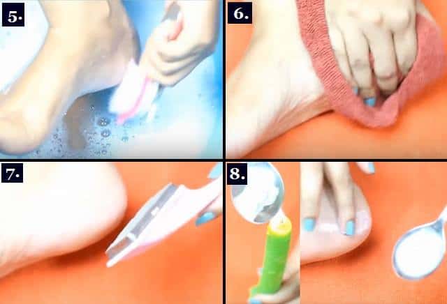 Heal cracked heels in week