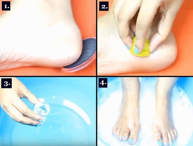 Heal cracked heels in week