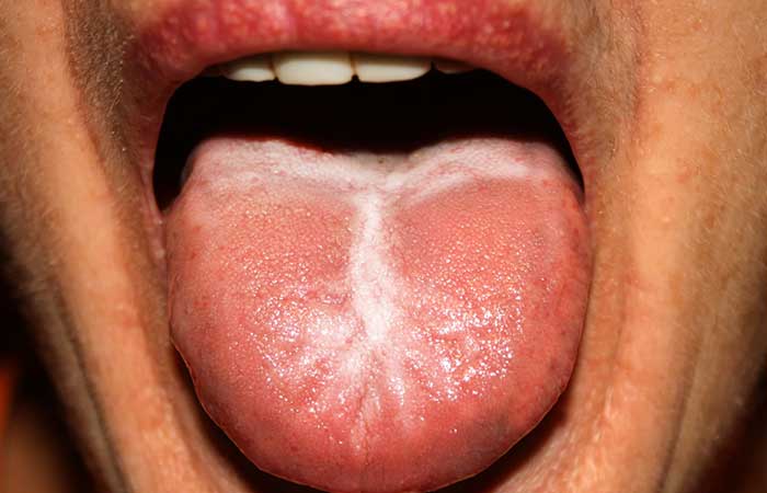 What your tongue can tell about your health