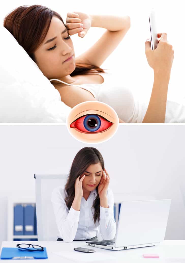 Tips To Take Care Of Sensitive Eyes