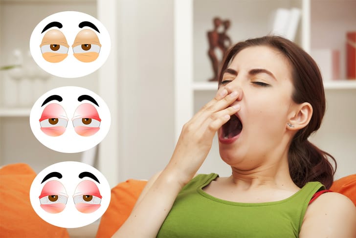 Tips To Take Care Of Sensitive Eyes