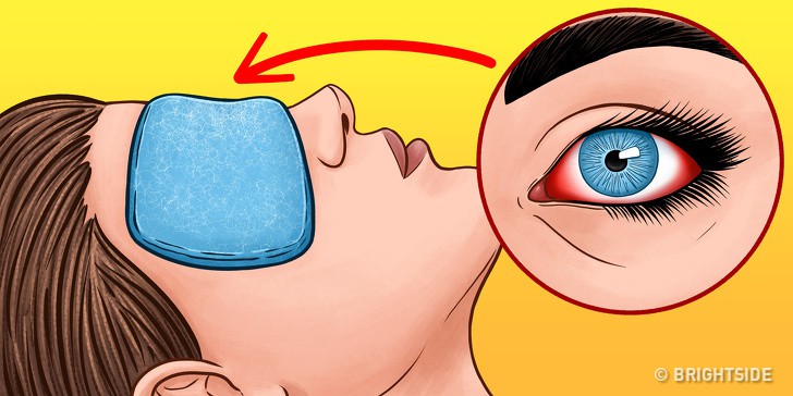 Tips To Take Care Of Sensitive Eyes