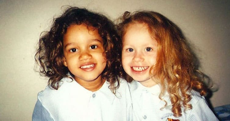 Cute Photos Of The Twin Sisters With Different Skin Colors 