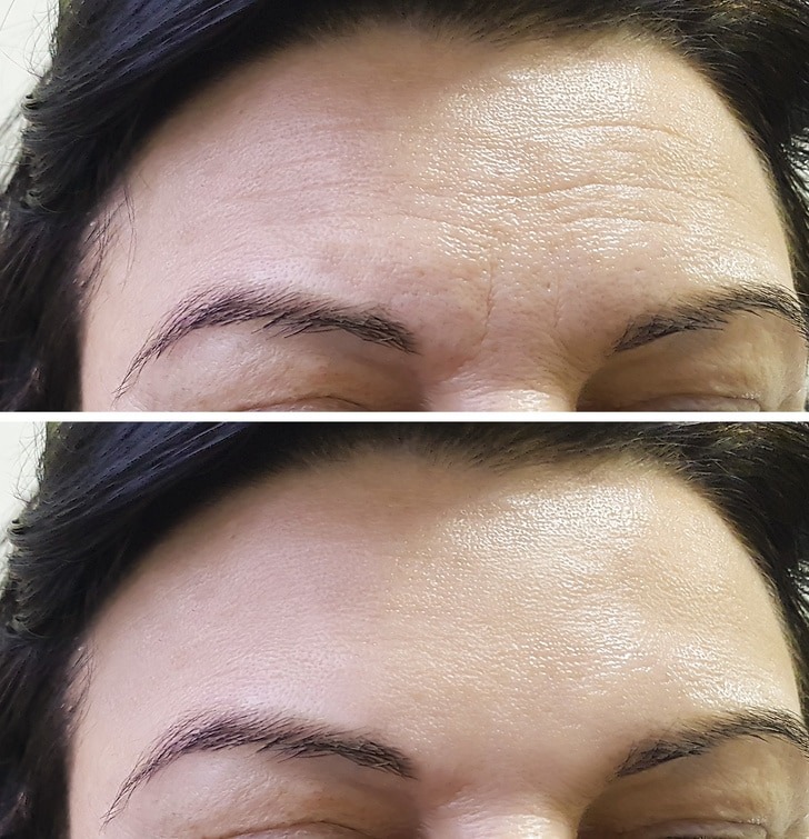 4 day exercises to lose weight and make you look younger