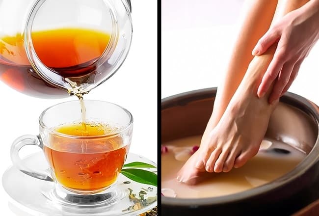Get Rid of Smelly Feet