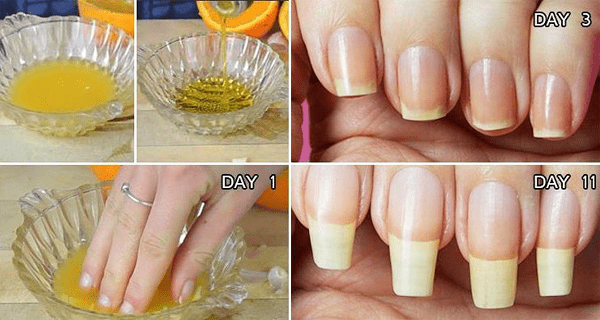 Nail Growth