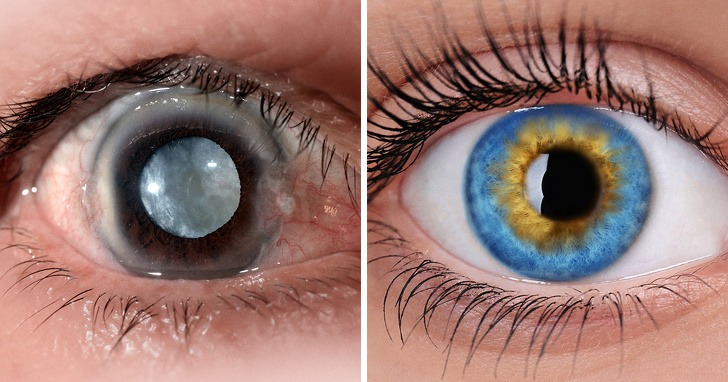 7 Foods that are beneficial for health