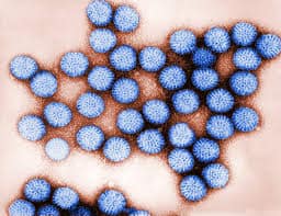 What Is Rotavirus? Causes, Treatment, and Prevention