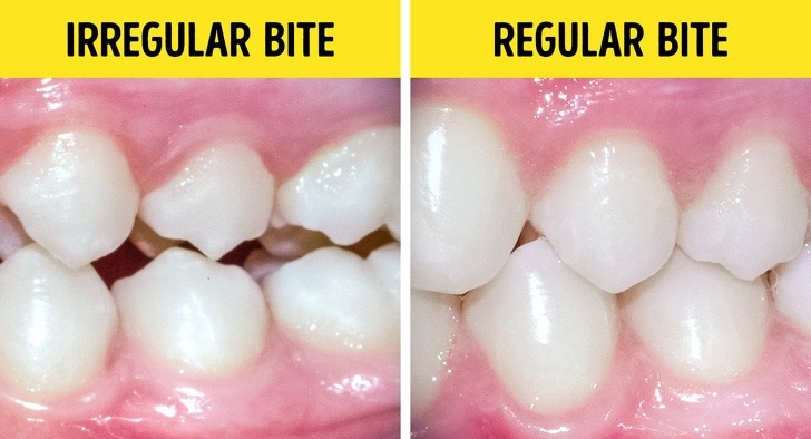 5 Myths about orthodontist