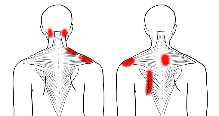 6 Exercise for relieving your neck and shoulder pain