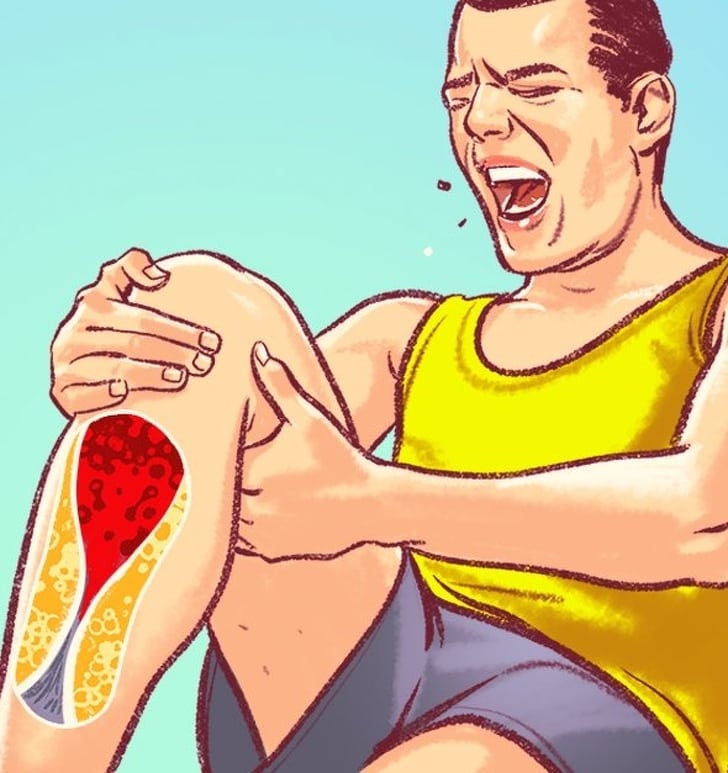 7 Symptoms of damaged arteries
