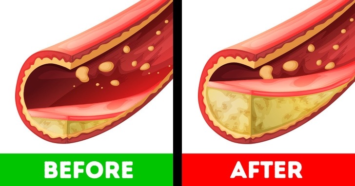 11 Effects of gaining extra weight