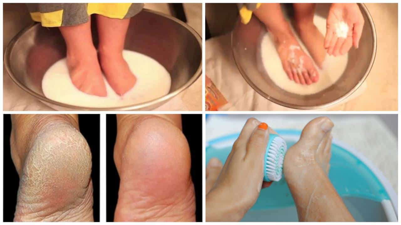6 Life changing home remedies