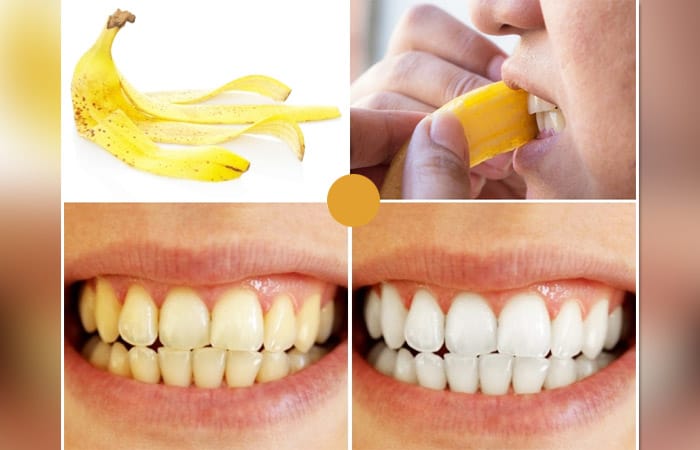 Benefits of banana peel