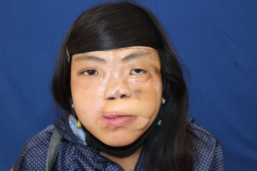 Have you embraced it?