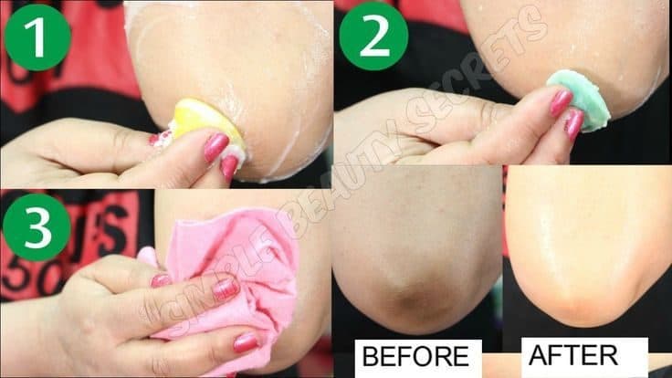 Lighten Dark Knuckles, Elbows And Finger Joints