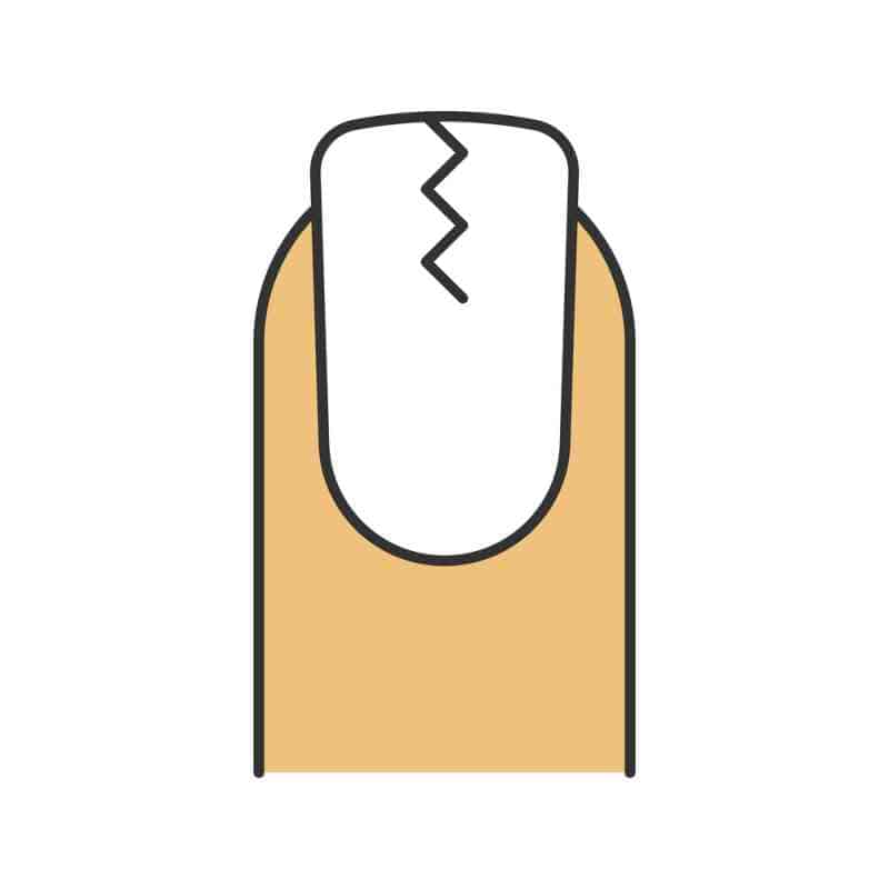 What Does Your Fingernails Indicate About Your Health