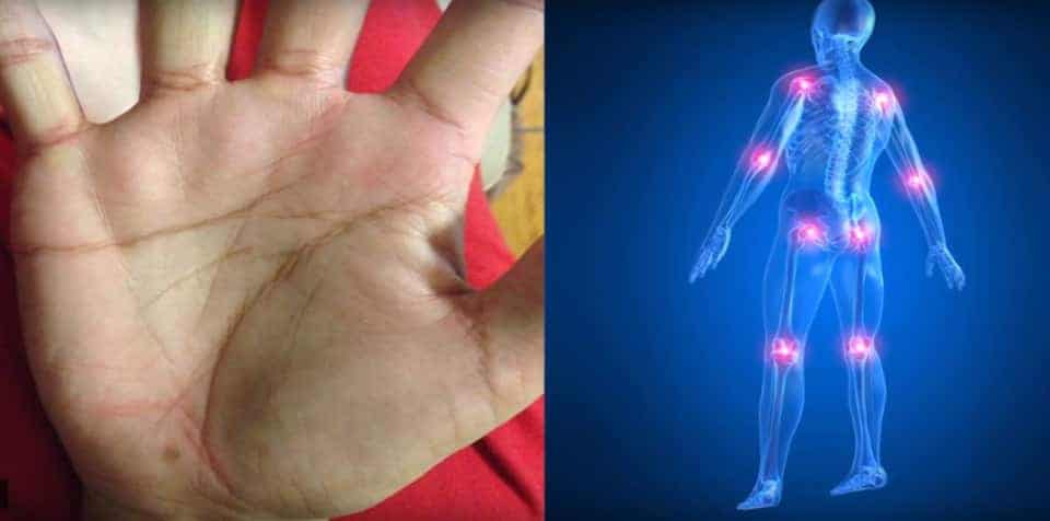 Your palm lines hold the secret of your life