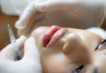 Descubre los Tratamientos Estéticos Más Demandados Close-up of a woman receiving a lip augmentation with a syringe by a professional.
